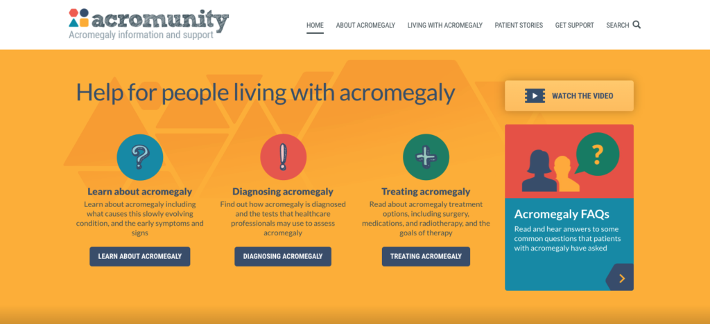 Acromegaly