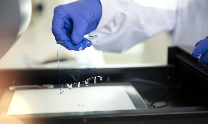 What's In The Pipeline For Ipsen Neuroscience