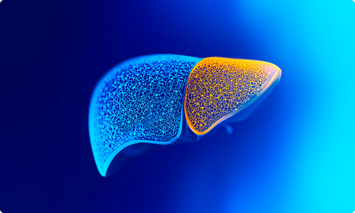 Ipsen’s science in rare cholestatic liver disease
