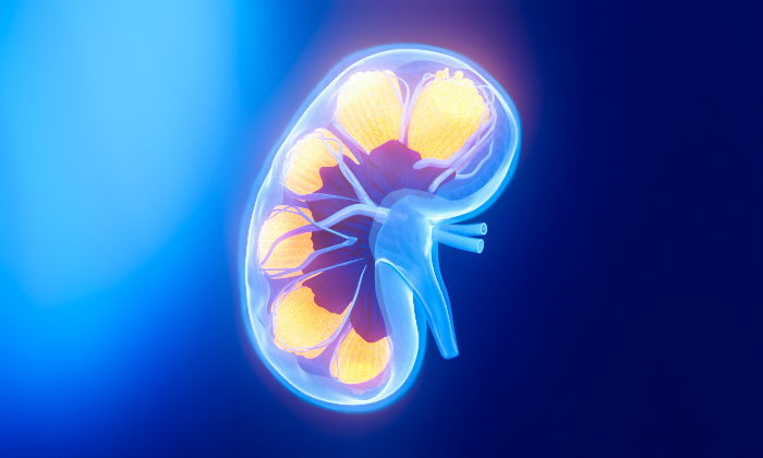 Ipsen’s science in rare kidney disease